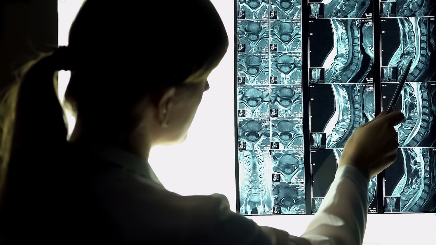 Surgeon looking at patient neck x-ray